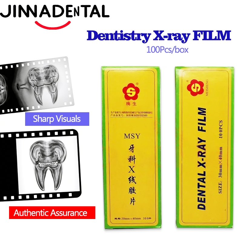 Film Rontgen Gigi 30*40mm, Fil - Medical Lab Images ulasan dan harga