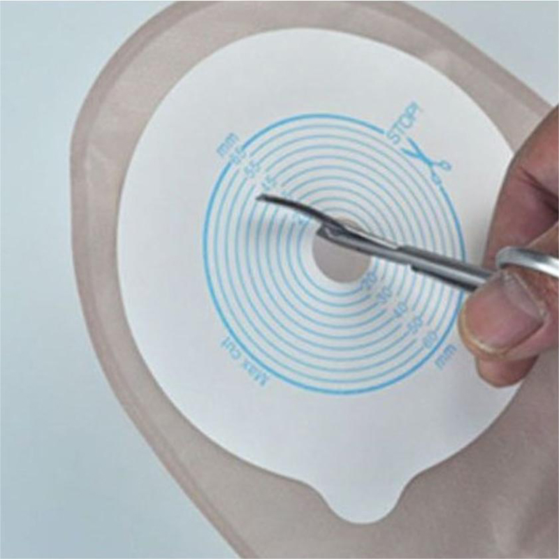 Tas Ostomy gunting kepala bula - Medical Scissors ulasan dan harga