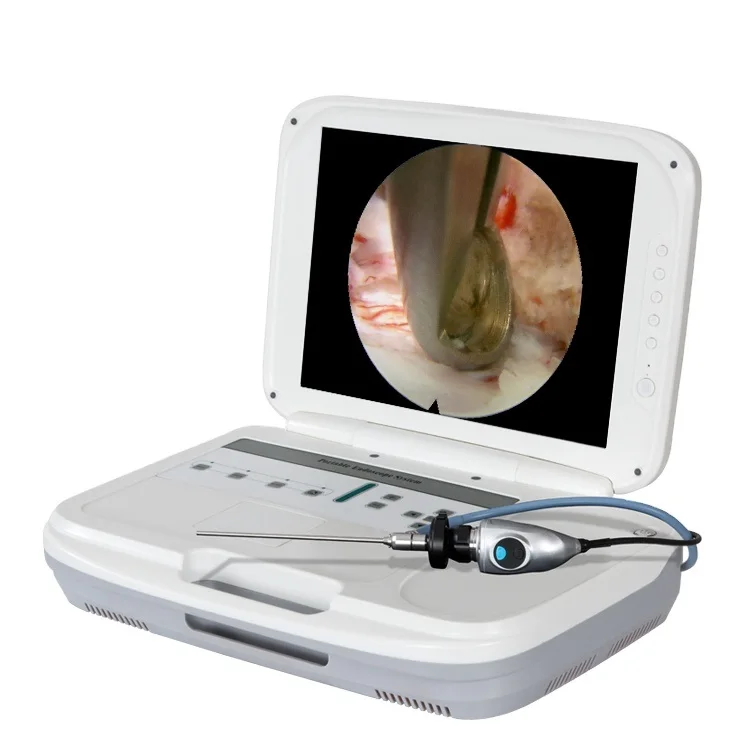 Sistem Endoskop Portabel Terin - Medical Lab Images ulasan dan harga